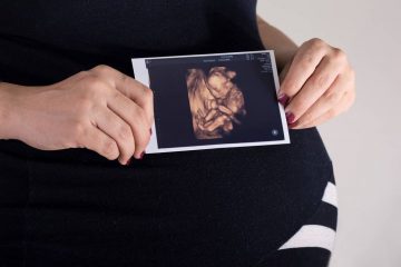 ecográfias-4d-primera-foto-bebe